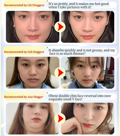 🔥Hot Sale🔥💁‍♀️face slimming mask🙆‍♀️ 🚚Cash on delivery